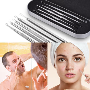 Trusa 5 instrumente inox pentru extractia comedoanelor si a punctelor negre