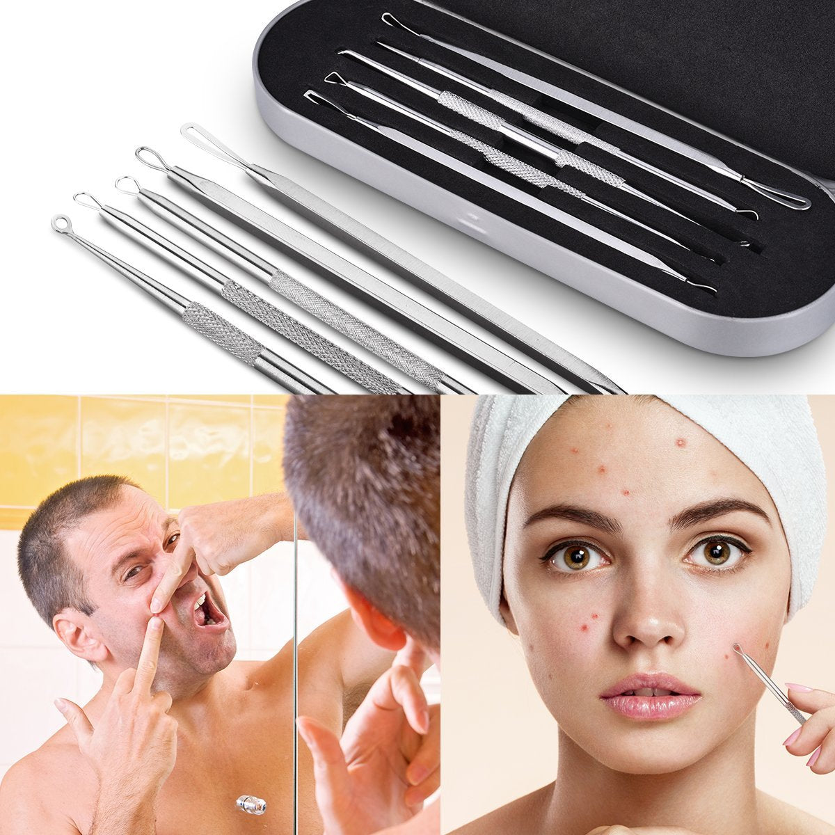 Trusa 5 instrumente inox pentru extractia comedoanelor si a punctelor negre